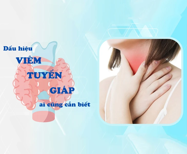 Dấu hiệu viêm tuyến giáp ai cũng cần biết
